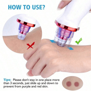 Best Blackhead Remover Vacuum Pore on AliExpress in 2026