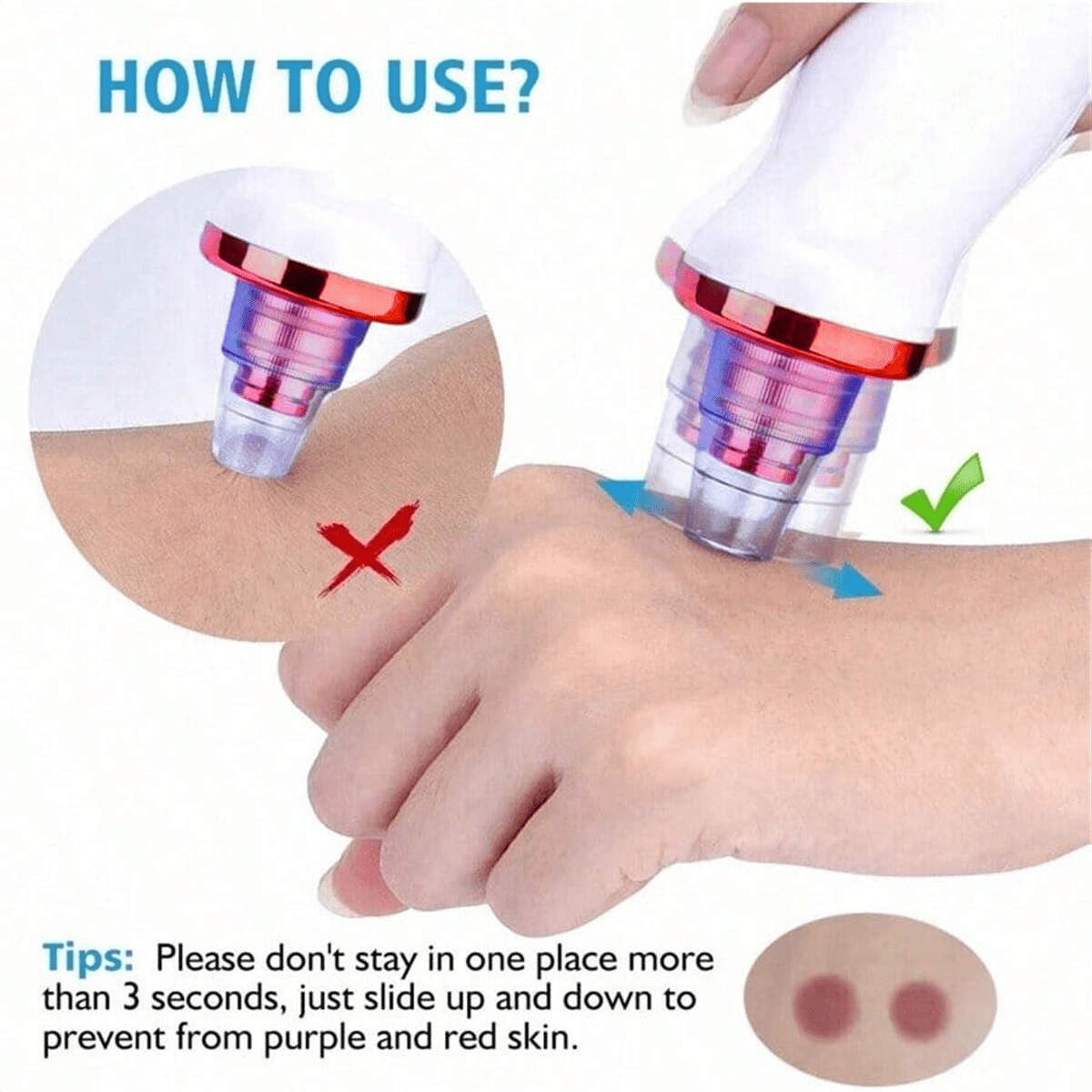Best Blackhead Remover Vacuum Pore on AliExpress in 2026