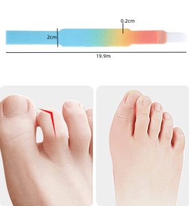 Best Bunion Corrector Splint on AliExpress in 2026