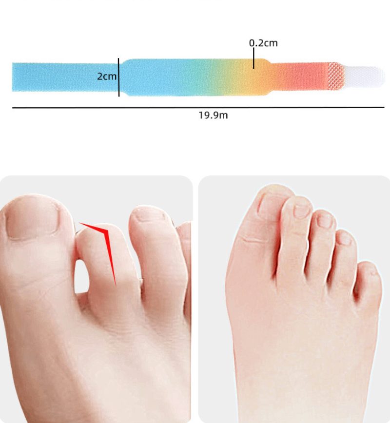 Best Bunion Corrector Splint on AliExpress in 2026